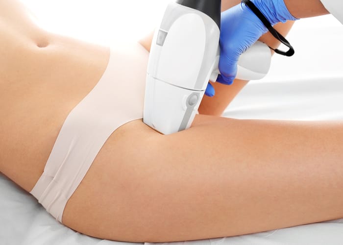 Genital Bölge Lazer Epilasyon Yaptıranların Yorumları Genital Bölge Lazer Epilasyon Yaptıranların Yorumları